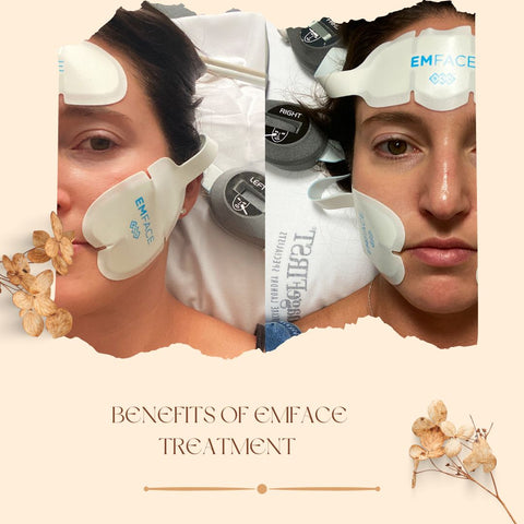 Benefits of Emface Treatment