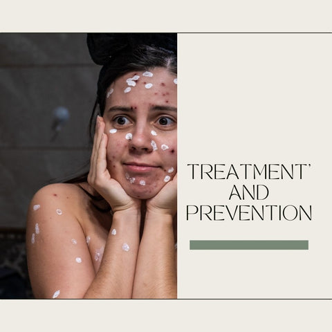 Treatment and Prevention