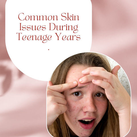 Common Skin Issues During Teenage Years