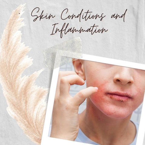 Skin Conditions and Inflammation