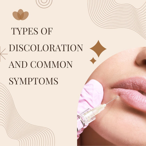 Types of Discoloration and Common Symptoms