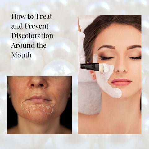 How to Treat and Prevent Discoloration Around the Mouth