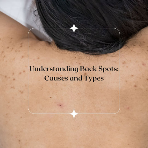 Understanding Back Spots: Causes and Types