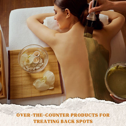 Over-the-Counter Products for Treating Back Spots