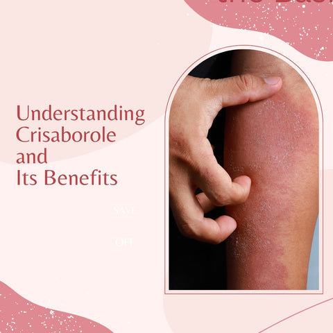 Understanding Crisaborole and Its Benefits