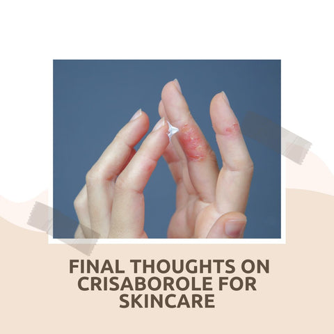 Integrating Crisaborole into Your Skincare Routine