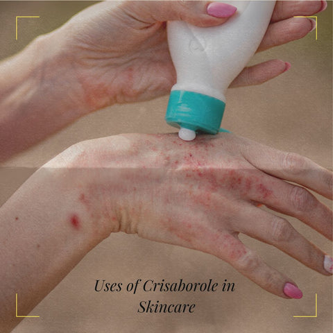 Uses of Crisaborole in Skincare