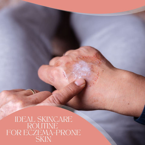 Ideal Skincare Routine for Eczema-Prone Skin