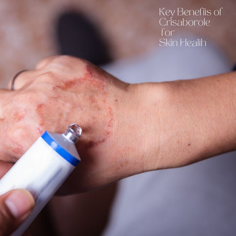 Key Benefits of Crisaborole for Skin Health