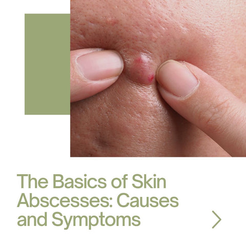 The Basics of Skin Abscesses: Causes and Symptoms