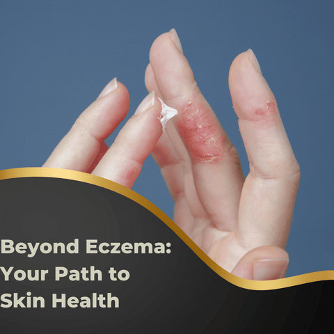 Beyond Eczema: Your Path to Skin Health