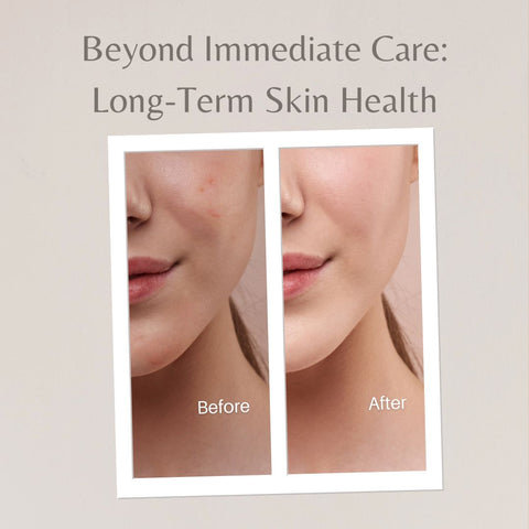 Beyond Immediate Care: Long-Term Skin Health