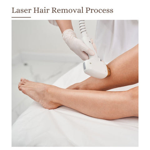 Laser Hair Removal Process: Step-by-Step Guide to a Hair-Free Future