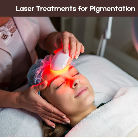 Laser Treatments for Pigmentation