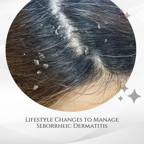 Lifestyle Changes to Manage Seborrheic Dermatitis