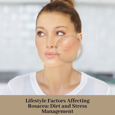 Lifestyle Factors Affecting Rosacea: Diet and Stress Management