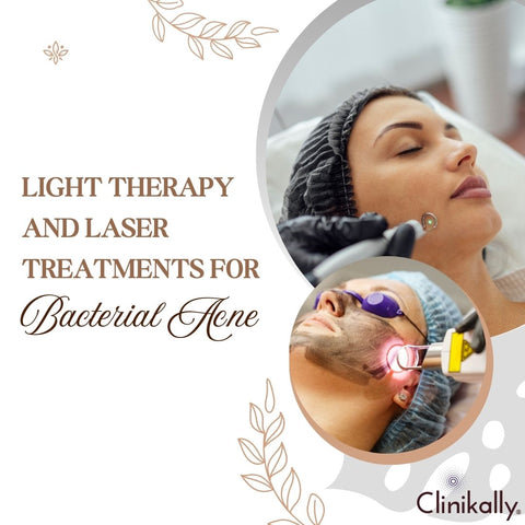 Light Therapy and Laser Treatments for Bacterial Acne