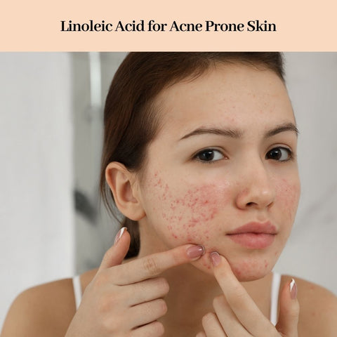 Linoleic Acid for Acne Prone Skin