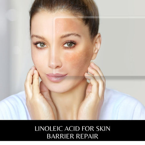 Linoleic Acid for Skin Barrier Repair