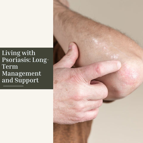 Living with Psoriasis: Long-Term Management and Support
