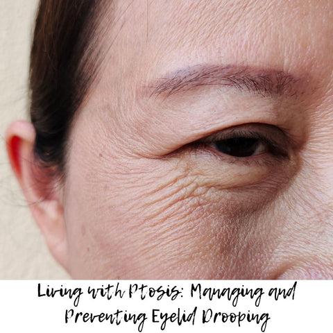 Living with Ptosis: Managing and Preventing Eyelid Drooping