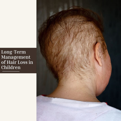 Long-Term Management of Hair Loss in Children