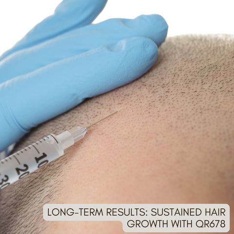 Long-Term Results: Sustained Hair Growth with QR678