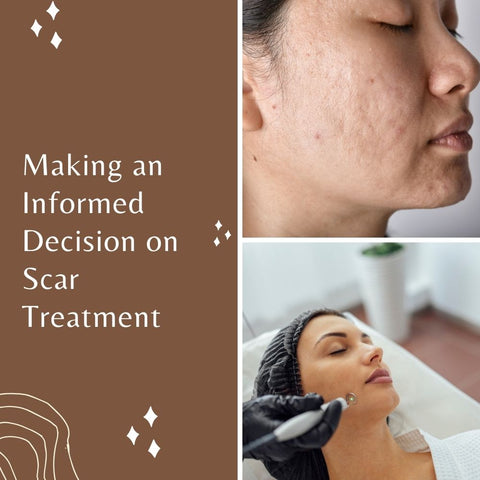 Making an Informed Decision on Scar Treatment