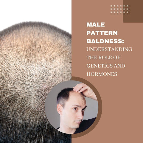 Male Pattern Baldness: Understanding the Role of Genetics and Hormones