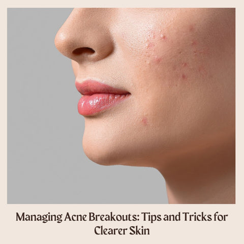 Managing Acne Breakouts: Tips and Tricks for Clearer Skin