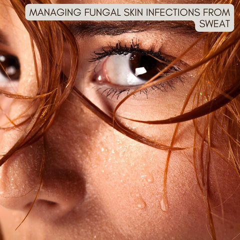Managing Fungal Skin Infections from Sweat