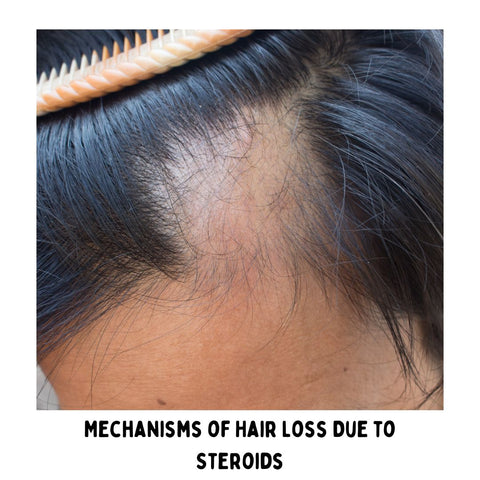 Mechanisms of Hair Loss Due to Steroids
