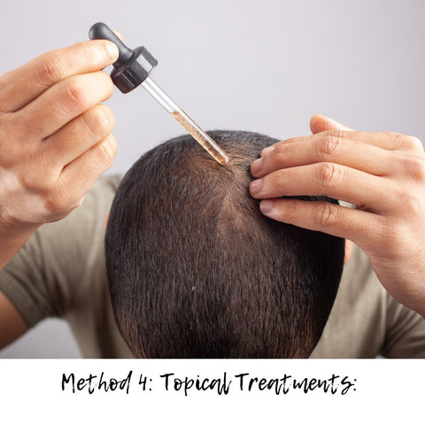 Method 4: Topical Treatments: Minoxidil and Beyond