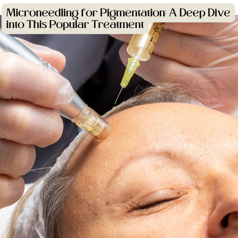 Microneedling for Pigmentation: A Deep Dive into This Popular Treatment