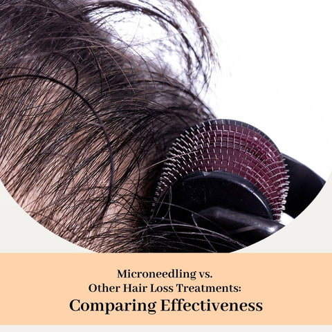 Microneedling vs. Other Hair Loss Treatments: Comparing Effectiveness