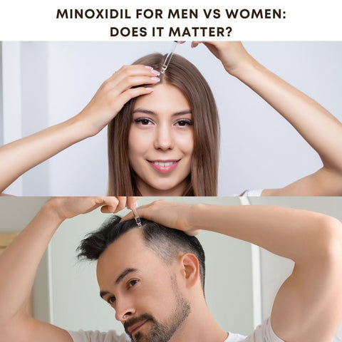 Minoxidil for Men vs Women: Does It Matter?