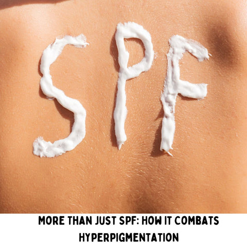 More Than Just SPF: How It Combats Hyperpigmentation
