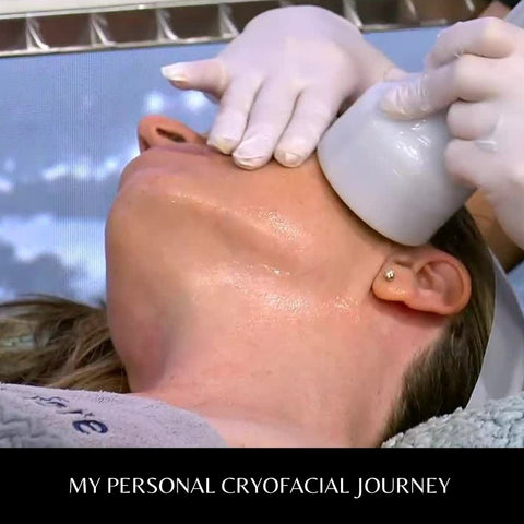 My Personal Cryofacial Journey