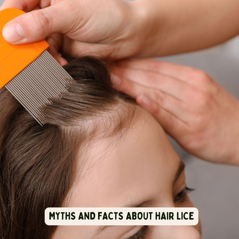 Myths and Facts About Hair Lice