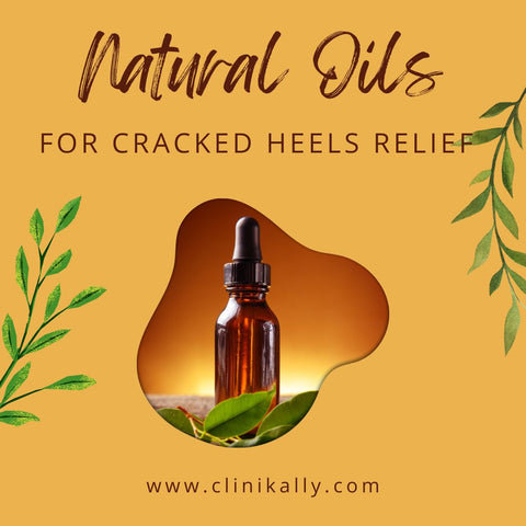 Natural Oils for cracked heels relief