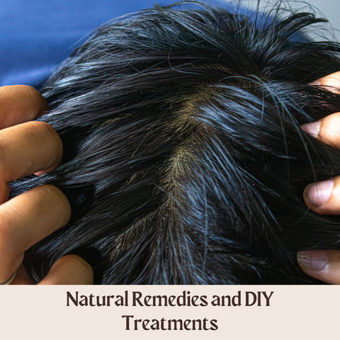 Natural Remedies and DIY Treatments