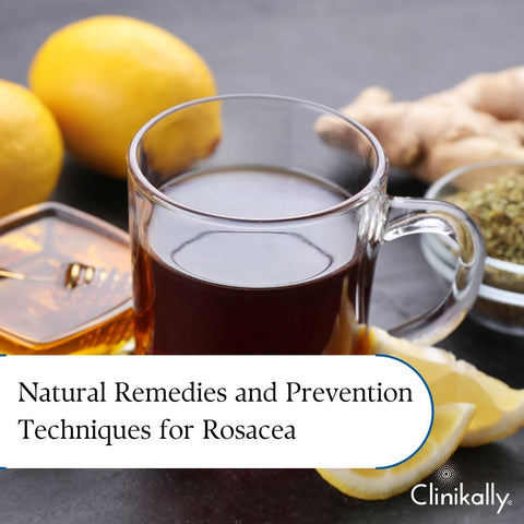 Natural Remedies and Prevention Techniques for Rosacea