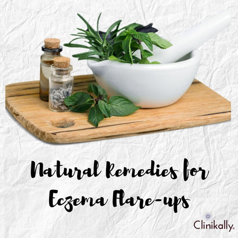 Natural Remedies for Eczema Flare-ups