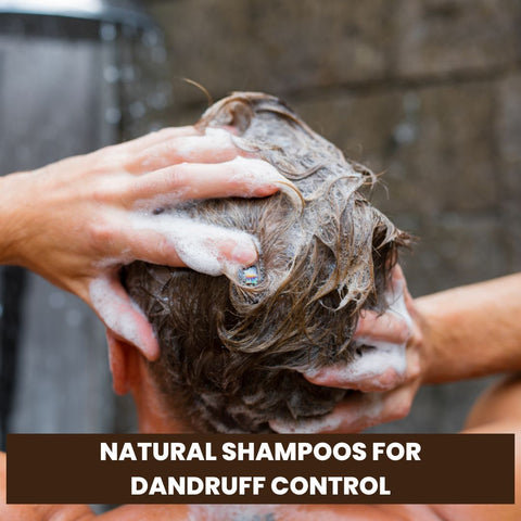 Natural Shampoos for Dandruff Control