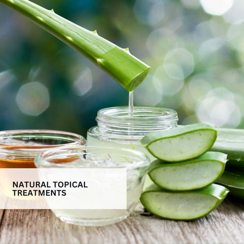 Natural Topical Treatments