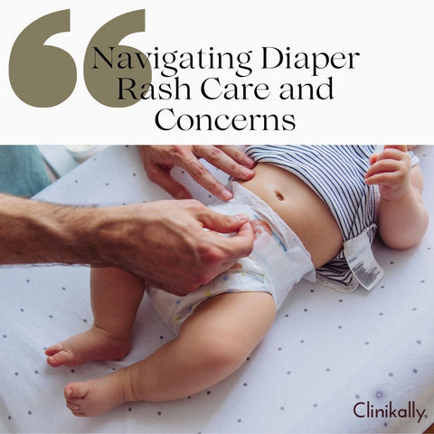 Navigating Diaper Rash Care and Concerns
