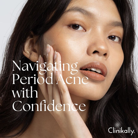 Conclusion: Navigating Period Acne with Confidence