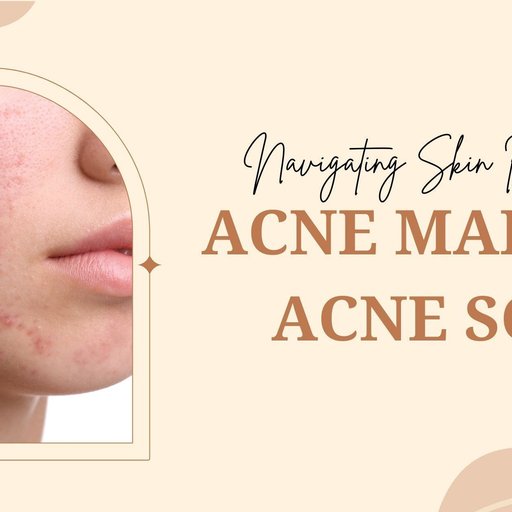 can glutathione remove pimple marks Acne vs Acne Scars: Key Differences & Treatments skincare ingredients