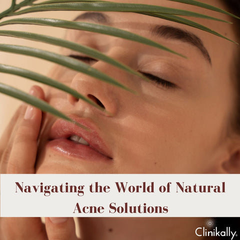 Navigating the World of Natural Acne Solutions