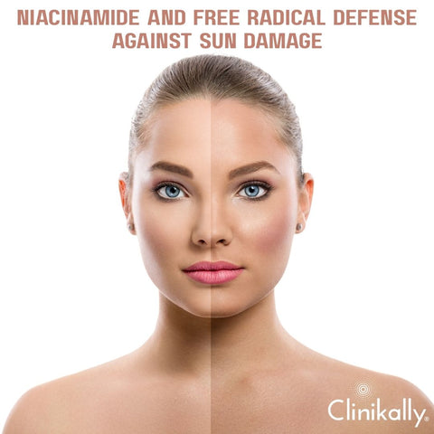 Niacinamide and Free Radical Defense Against Sun Damage